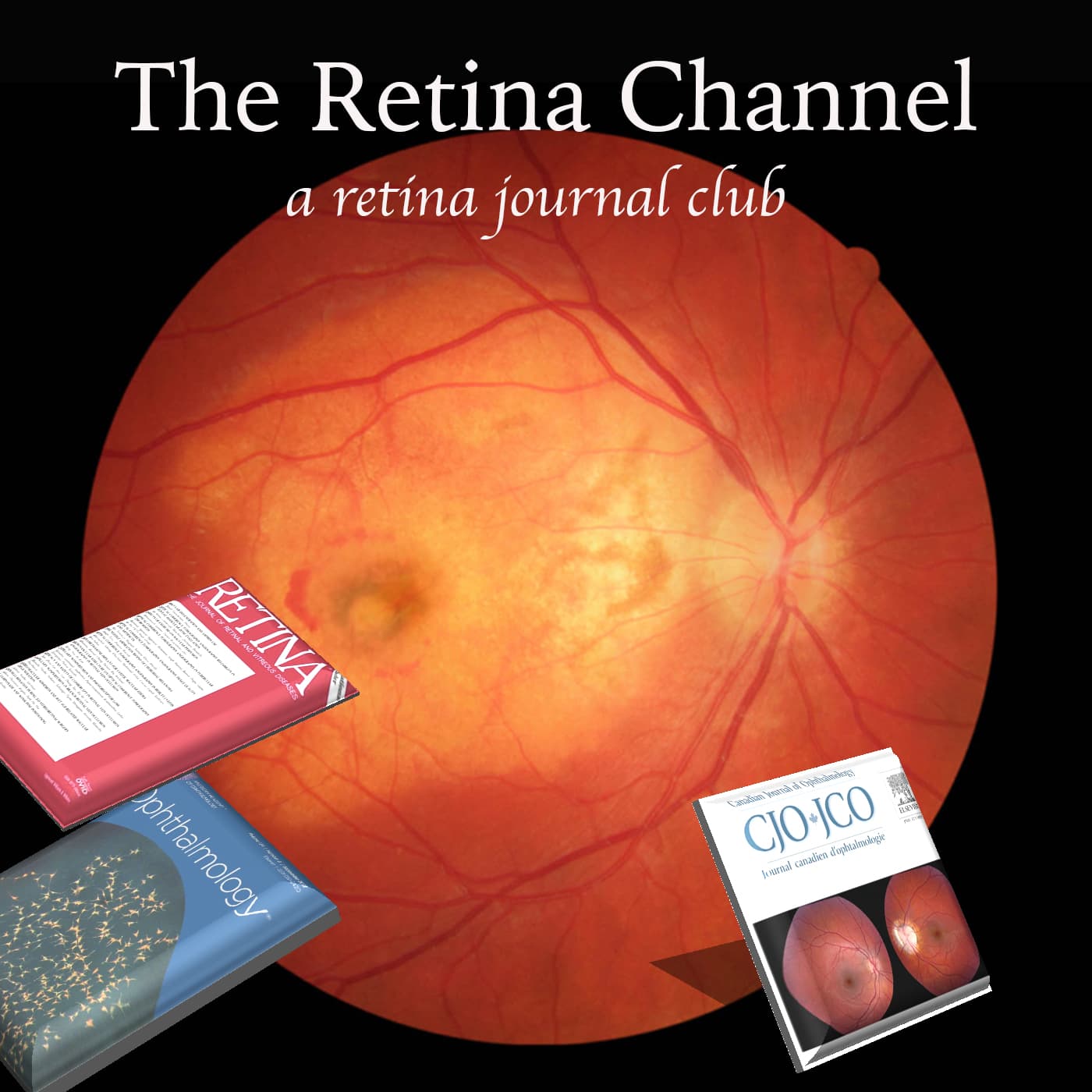 The Retina Channel Podcast podcast artwork