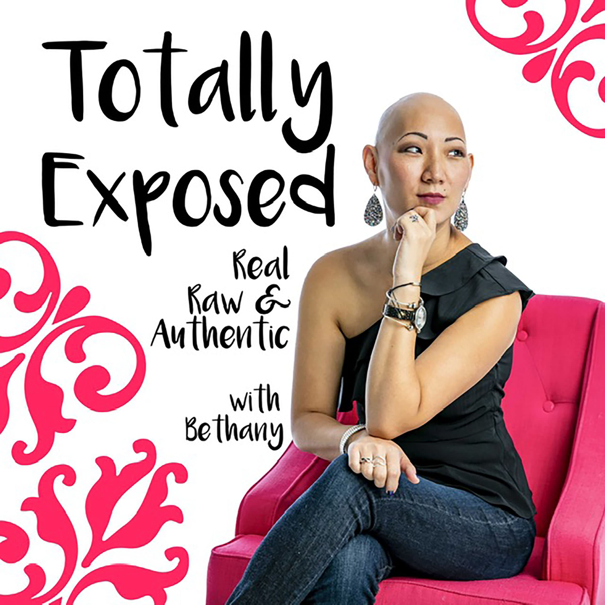 Totally Exposed: Real, Raw & Authentic podcast artwork
