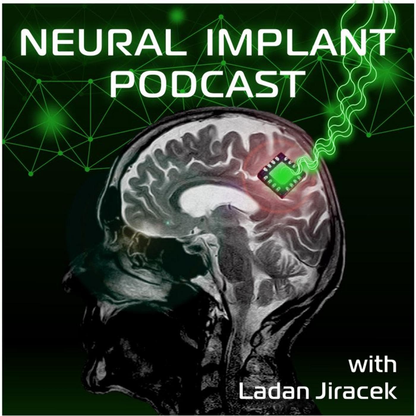 Neural Implant podcast - the people behind Brain-Machine Interface revolutions podcast artwork